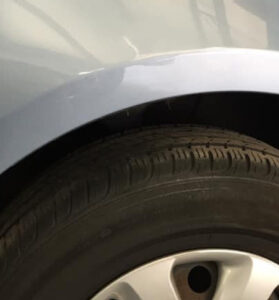 Dent Fixed
